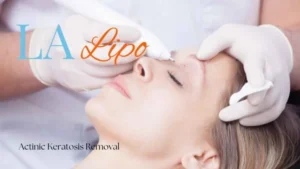 Woman receiving Actinic Keratosis Removal Treatment Kensington and Chelsea
