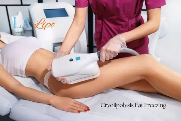 Woman receiving coolsculpting Kensington and Chelsea treatment on her thighs