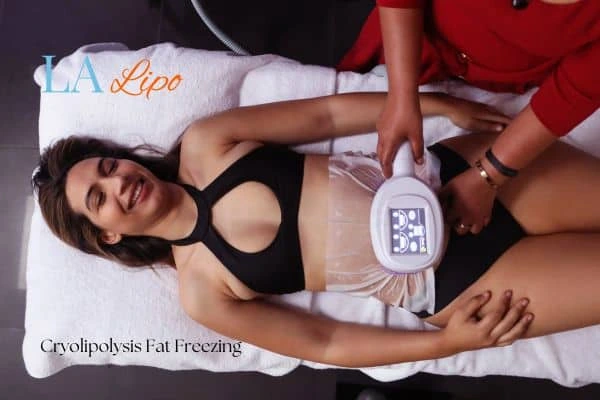 woman getting cryolipolysis Kensington and Chelsea