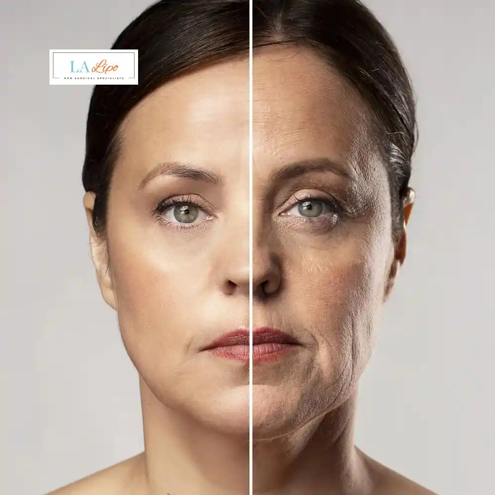 How Can You Tell If Non-Surgical Skin Tightening Is Right for You Kensington and Chelsea?
