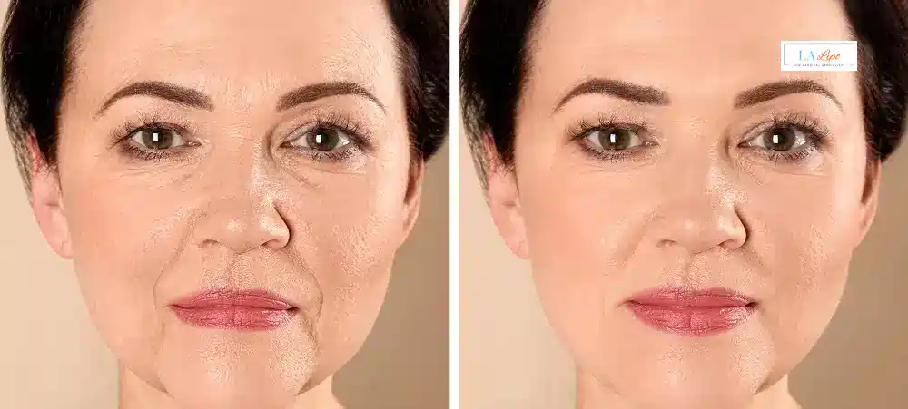 How Long Does It Take to See Results and How Long Do They Last Kensington and Chelsea?